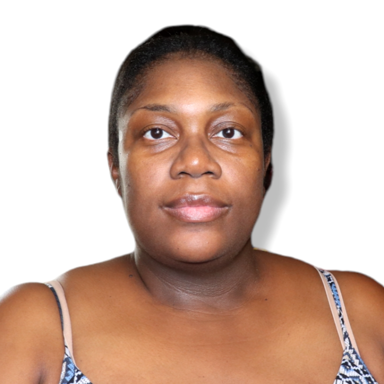 black woman with no makeup dark circles undereye